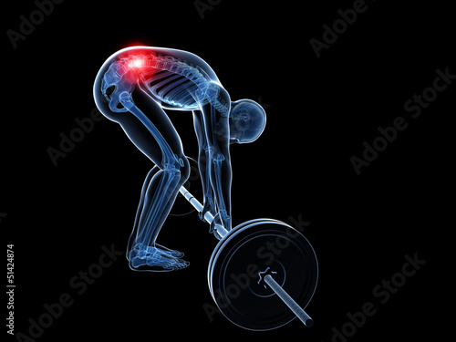 Illustration: 3d rendered medical illustration - wrong lifting posture 3d rendered medical illustration - wrong lifting posture
