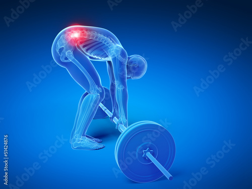Illustration: 3d rendered medical illustration - wrong lifting posture 3d rendered medical illustration - wrong lifting posture