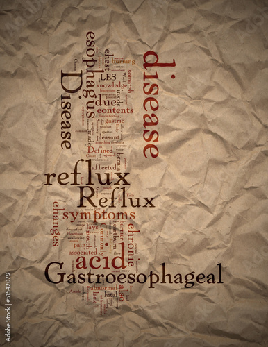 Illustration: Chronic Gastroesophageal Reflux Disease Chronic Gastroesophageal Reflux Disease