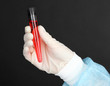 Photo: Glass tube with fluid in scientist hand during medical test Glass tube with fluid in scientist hand during medical test
