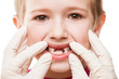 Dentist examining child teeth