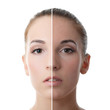 Photo: Beautiful girl with problems on face Beautiful girl with problems on face