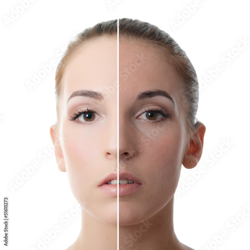 Photo: Beautiful girl with problems on face Beautiful girl with problems on face