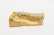 A finished model of posterior dental bridge