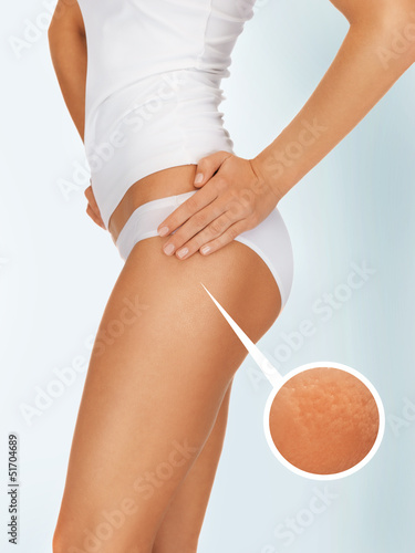 Photo: slimming concept slimming concept