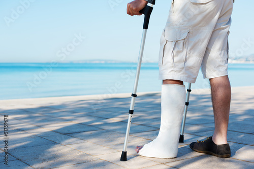 Photo: gipsbein im urlaub gipsbein im urlaub