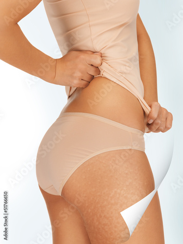 Photo: slimming concept slimming concept