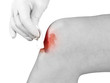 Hand disinfecting wound on hand knee.