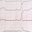 cardiogram