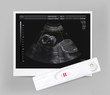 Ultrasound of baby in mother's womb and positive pregnancy test