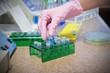 Photo: test tubes and hand test tubes and hand