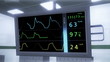 High Tech Operation Room Hospital Interior EKG ECG monitor