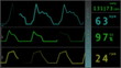 EKG ECG monitor extreme close up macro