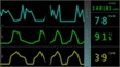 EKG ECG monitor extreme close up macro