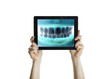 Foto: Dental closeup with tablet Dental closeup with tablet