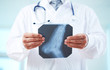 Photo: X-ray of foot X-ray of foot