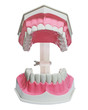 Photo: Closeup of plastic teeth and gum model Closeup of plastic teeth and gum model