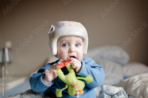 Photo: baby with helment for Plagiocephaly baby with helment for Plagiocephaly