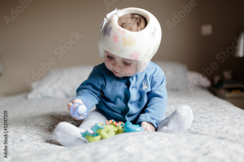 Photo: baby with helment for Plagiocephaly baby with helment for Plagiocephaly