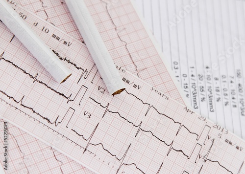 Photo: Heart disease caused by cigarettes and smoking Heart disease caused by cigarettes and smoking