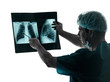 doctor surgeon radiologist examaning lung torso  x-ray image