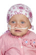 Photo: Adorable baby beating the disease Adorable baby beating the disease