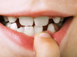 Child shows tooth