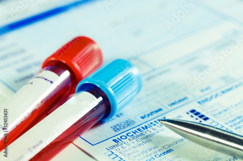 Photo: Biochemistry blood tests Biochemistry blood tests