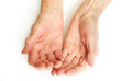 Photo: Old Lady's hands open - My mother at 90 years old Old Lady's hands open - My mother at 90 years old