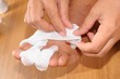 Wounds on women foot