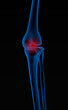 Knee