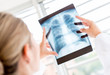 Doctor looking at an x-ray
