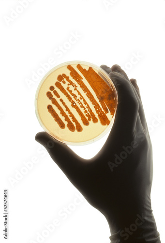 Photo: Petrie dish with bacteria used for R&D Petrie dish with bacteria used for R&D