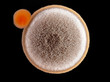 agar culture