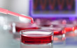 pipette