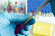 hand of a scientist collecting a sample