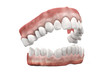 Jaw with teeth