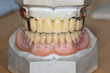 Dental-Nostalgie