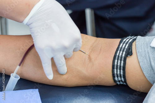 Photo: A large bore needle is inserted for blood donation A large bore needle is inserted for blood donation