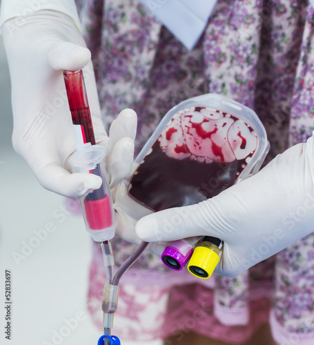 Photo: Blood test Blood test