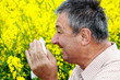 Man with hay fever on blooming rapeseed field