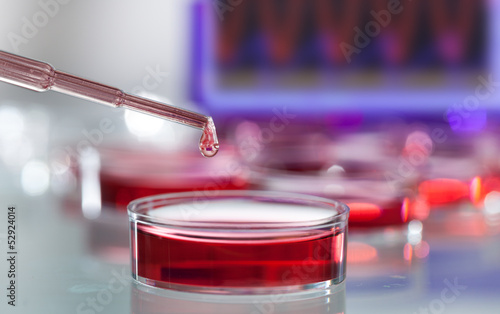 Photo: pipette pipette