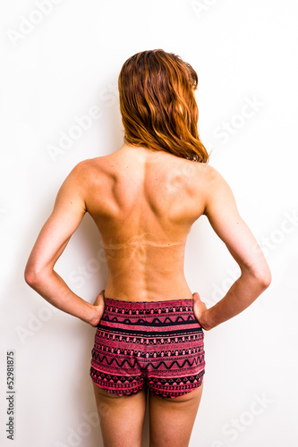 Photo: Topless woman in shorts with tan lines from sunbathing Topless woman in shorts with tan lines from sunbathing