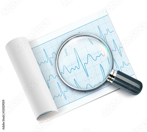 Illustration: Cardiogram Cardiogram