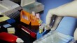 Experiment in the microbiology laboratory