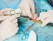 operation