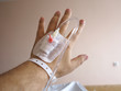 Patient's hand in the hospital with an IV