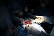 cardiac surgery. open heart