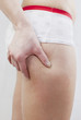 cellulite
