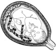 Fetus in his womb cut